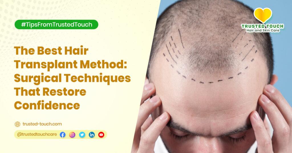 The Best Hair Transplant Method